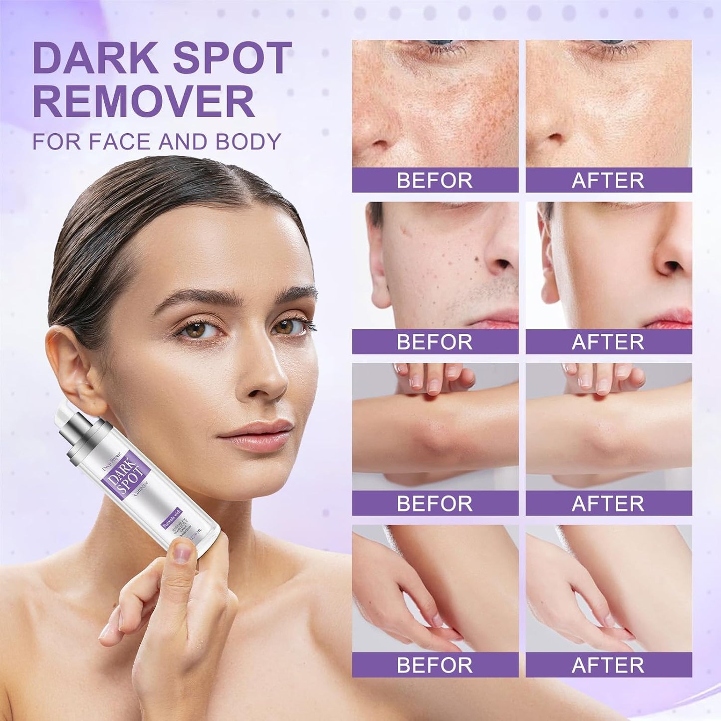 Dark Spot Remover for Face and Body, Dark Spot Corrector Cream, Skin Brown Spot Remover, Age Spot Remover with Retinol for Rapid Tone Repair Sun Spot Brown Spots Age Spots Freckles 1.7 Oz (Pack of 1)