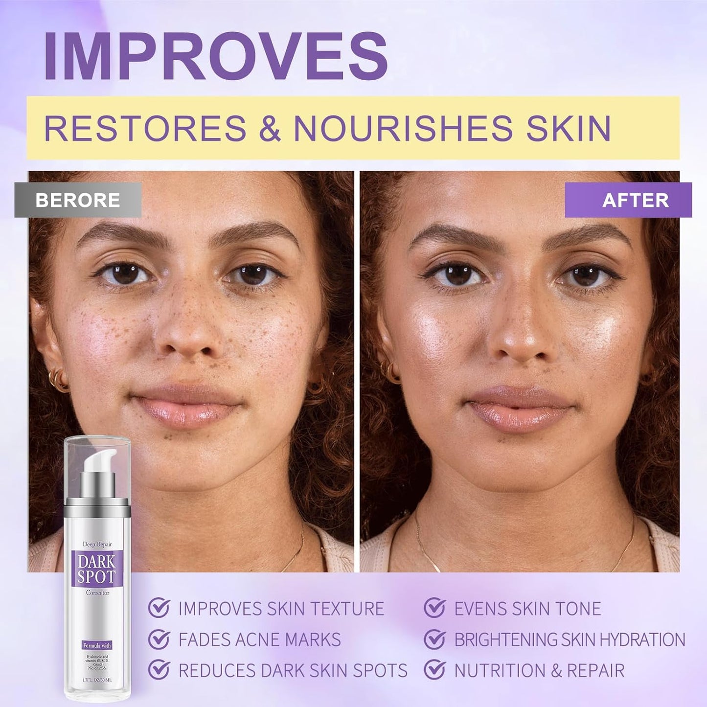 Dark Spot Remover for Face and Body, Dark Spot Corrector Cream, Skin Brown Spot Remover, Age Spot Remover with Retinol for Rapid Tone Repair Sun Spot Brown Spots Age Spots Freckles 1.7 Oz (Pack of 1)