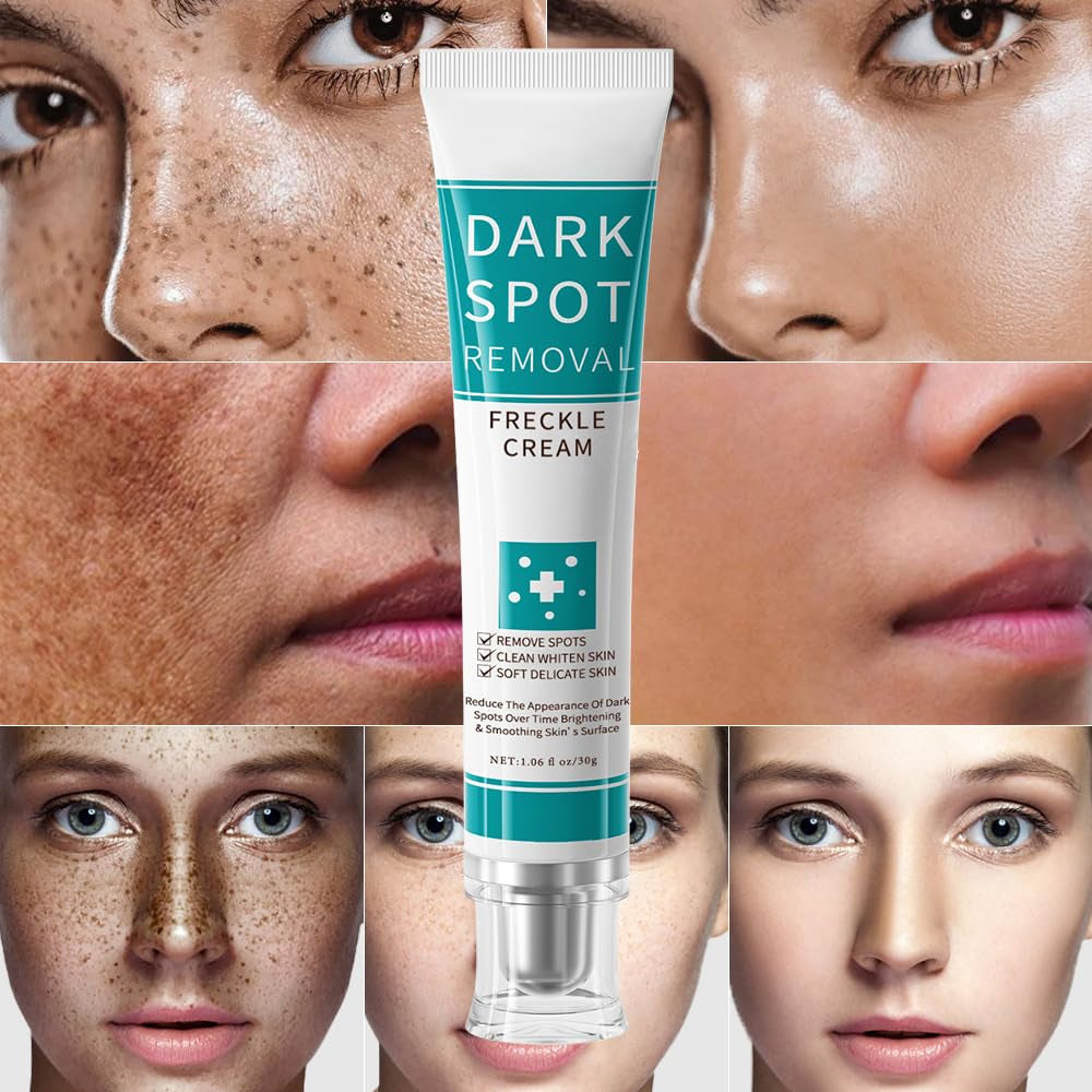 Dark Spot Remover for Face & Body, Nicotinamide Freckle Remover Cream,Anti-Aging Dark Spot Corrector for Age Spot,Sun Spot, Hyperpigmentation,And Melasma, Moisturizing & Gentle on Skin,1 Oz