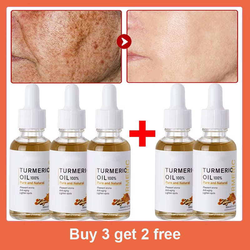 Dark Spot Remover Serum Turmeric Oil Whitening Freckle Facial Serum Anti-Aging Reduce Fine Lines Lighten Spots Melanin Skin Care